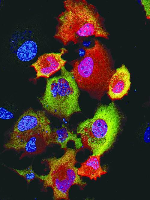 《自然—生物技术》11月刊封面图片,它显示了利用荧光rna可对单细胞中